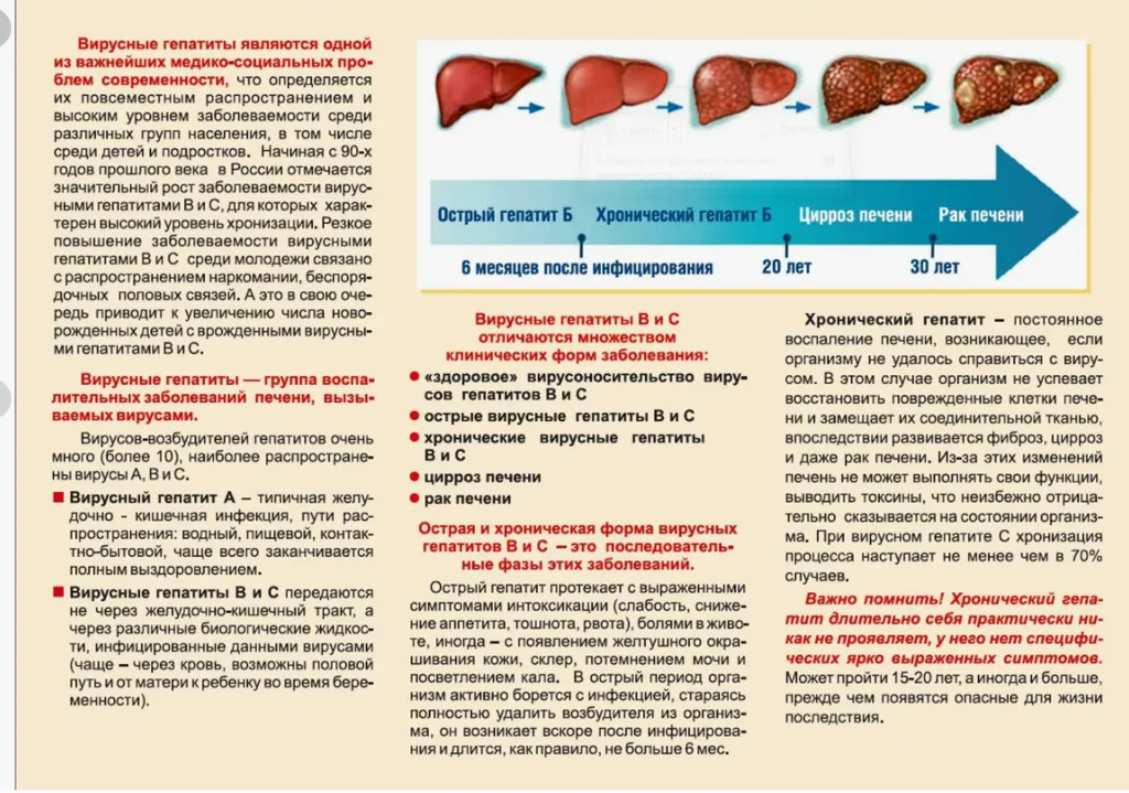 Вирусные гепатиты
